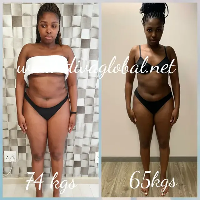 Before and after treatment