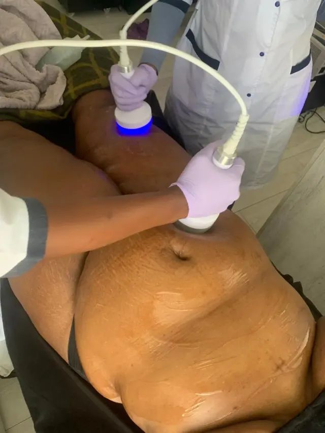 Magnetic wave and radio frequency treatment step