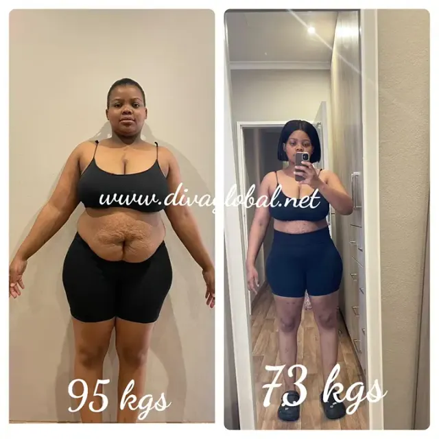 Before and after treatment