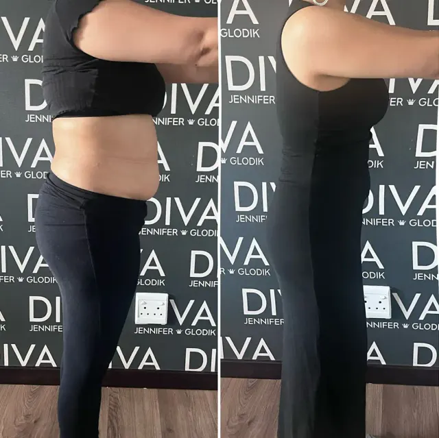 Before and after treatment