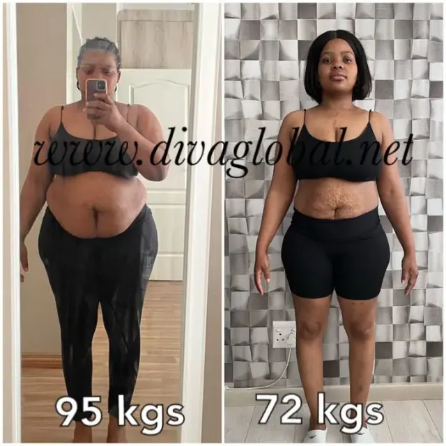 Before and after treatment