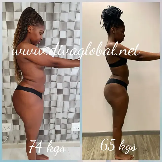 Before and after treatment