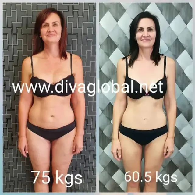 Before and after treatment