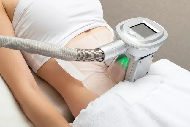 Cryotechnology -Fat Freeze 