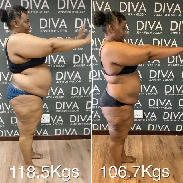 Before and after treatment
