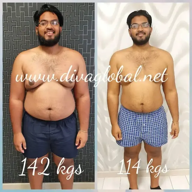 Before and after treatment