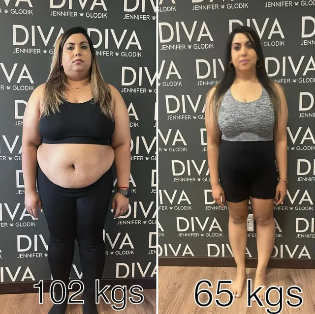 Before and after treatment