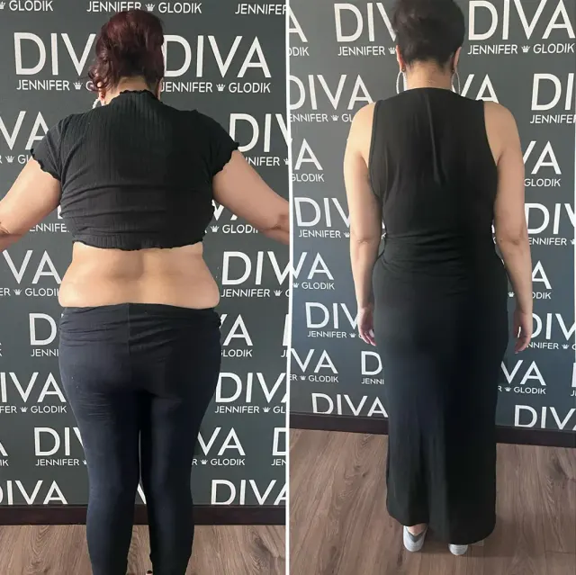 Before and after treatment