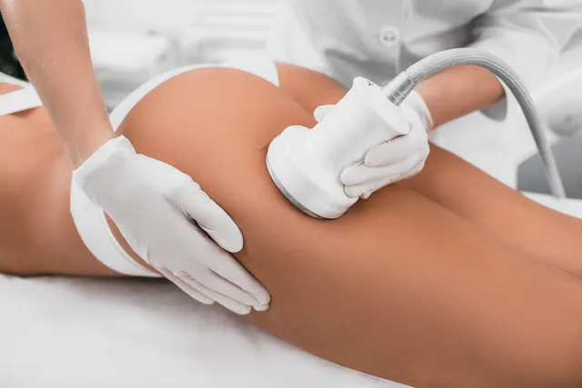 What is Ultrasound liposuction - weight loss technology