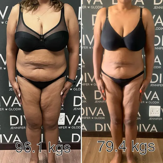 Before and after treatment