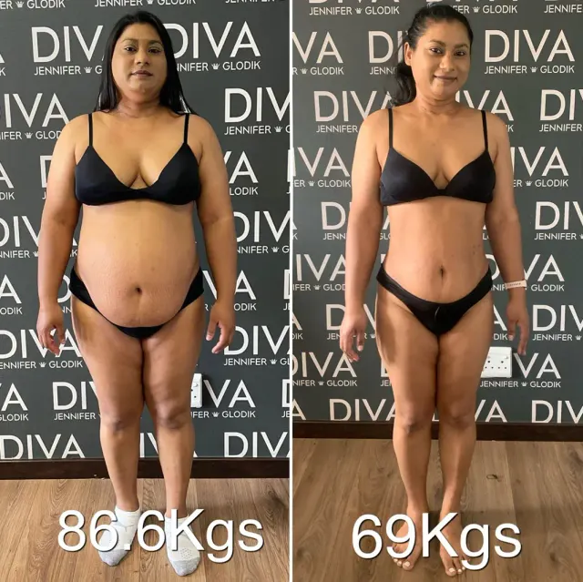 Before and after treatment