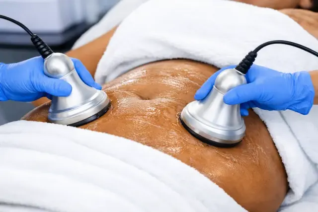 Ultrasound liposuction treatment areas