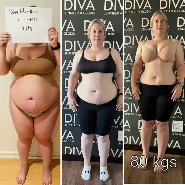 Before and after treatment