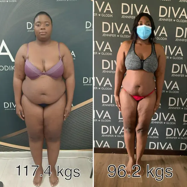 Before and after treatment