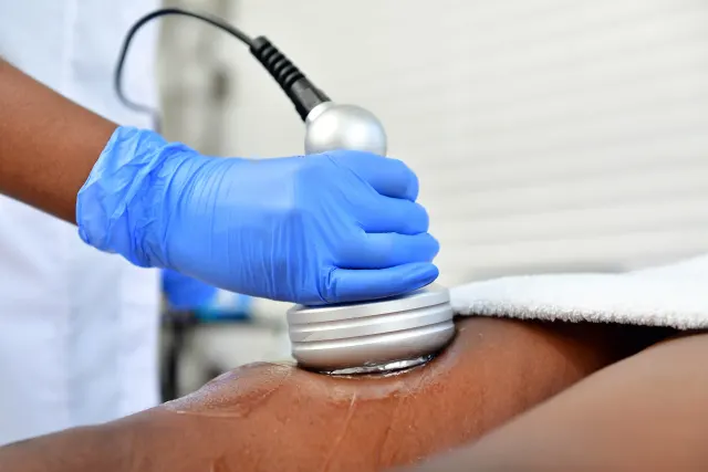 Radio frequency treatment step