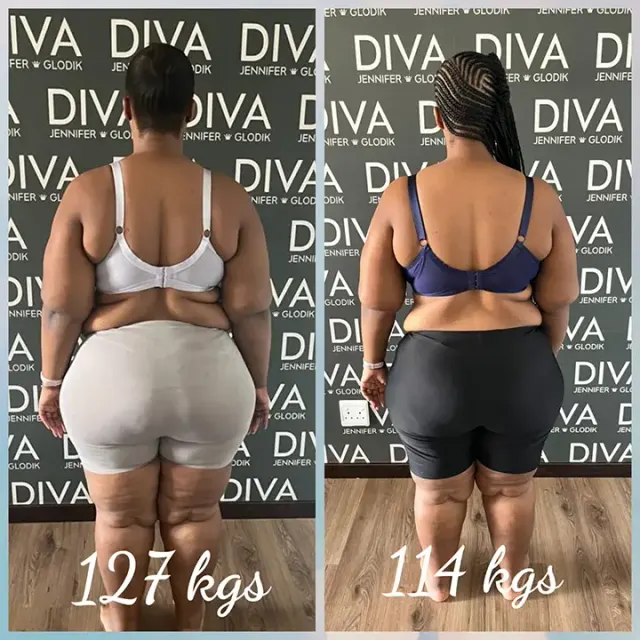 Before and after treatment