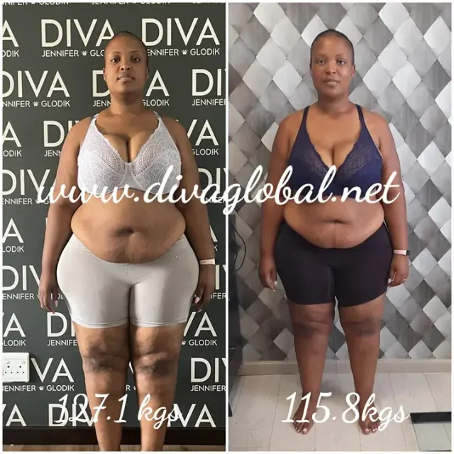 Before and after treatment